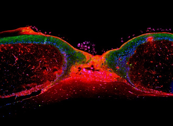 Das Titelbild zeigt das Wundareal eines organotypischen in vitro Hautmodells drei Tage nach Verwundung. Hautzellen, die 24 h nach Verwundung mit einem roten Fluoreszenzfarbstoff markiert wurden, lagern sich im oberen Kompartiment der sich ausbildenden Migrationszunge an. Die beiden Migrationszungen fusionieren in der Mitte des Wundareals und bilden dort die Neoepidermis. Die grüne Occludin-Fluoreszenzfärbung kennzeichnet die Tight-junctions der Keratinozyten. Wird die Funktion der Tight-junctions durch Einbringung eines Peptids gestört, können sich die pertubierten Keratinozyten (rosa) nicht in die Migrationszunge einlagern und lösen sich ab. Quelle: Das Bild wurde mit einem Nanozoomer (Hamamatsu) im TIGA-Center (Bioquant, Universität Heidelberg) aufgenommen.