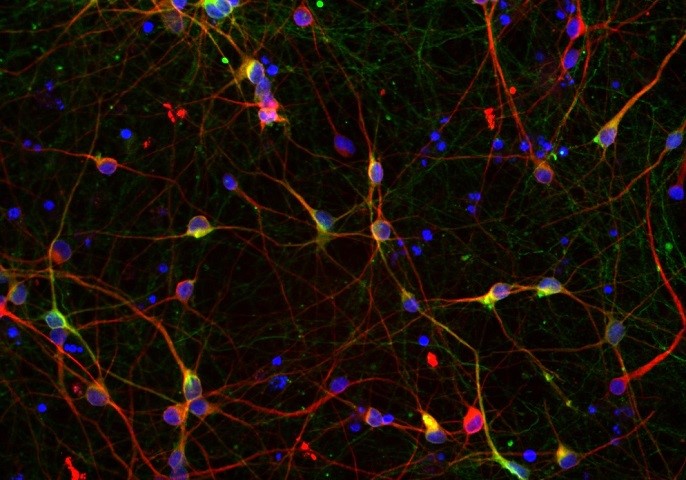 Auf dem Mikroskopie­-Bild sind in Rot Neuronen und in Blau Zellkerne zu erkennen. Die Überlagerung mit Grün zeigt Dopamin erzeugende Neuronen an. 